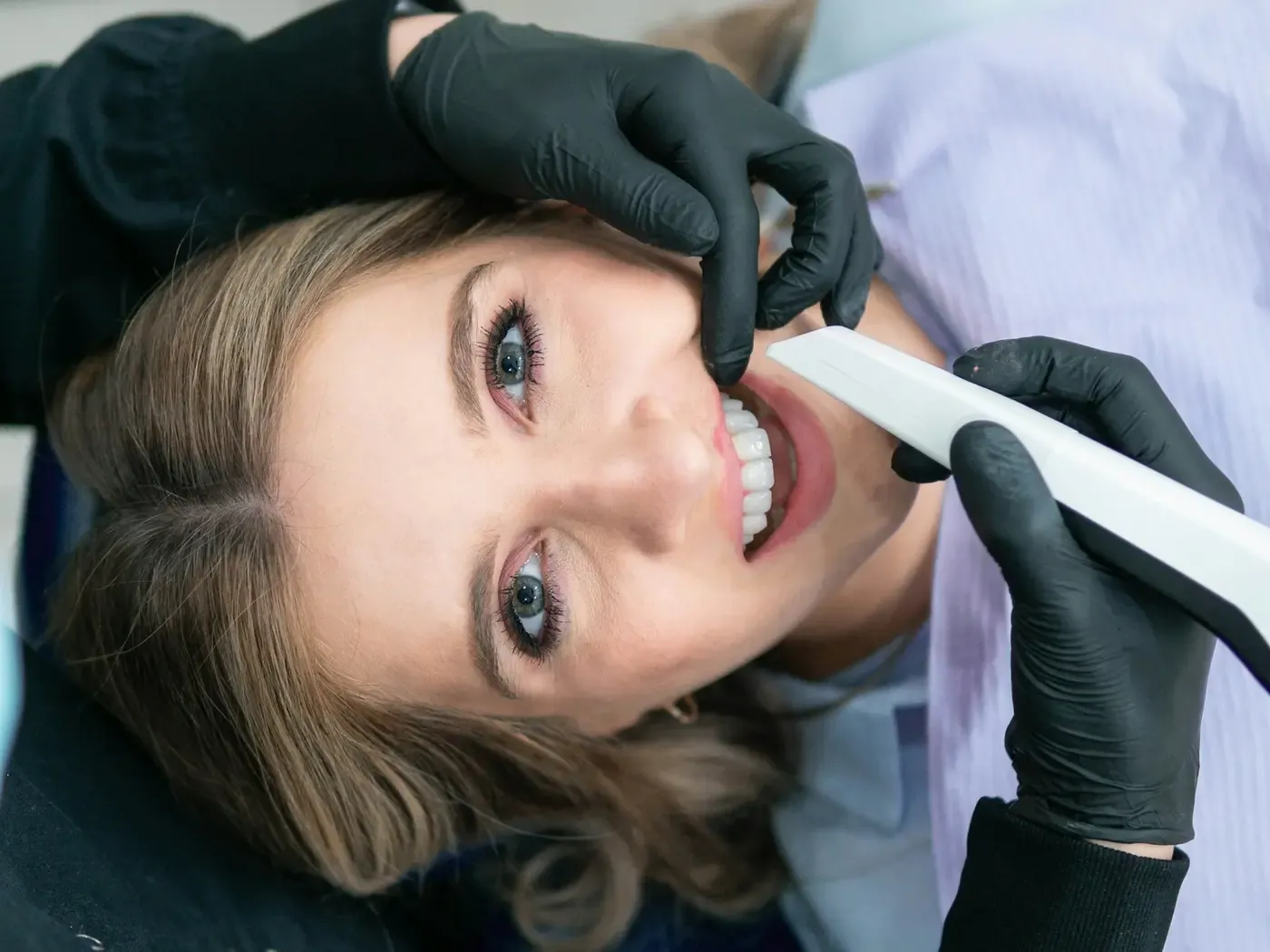 How long do veneers last? Daily care from an Etiler dentist